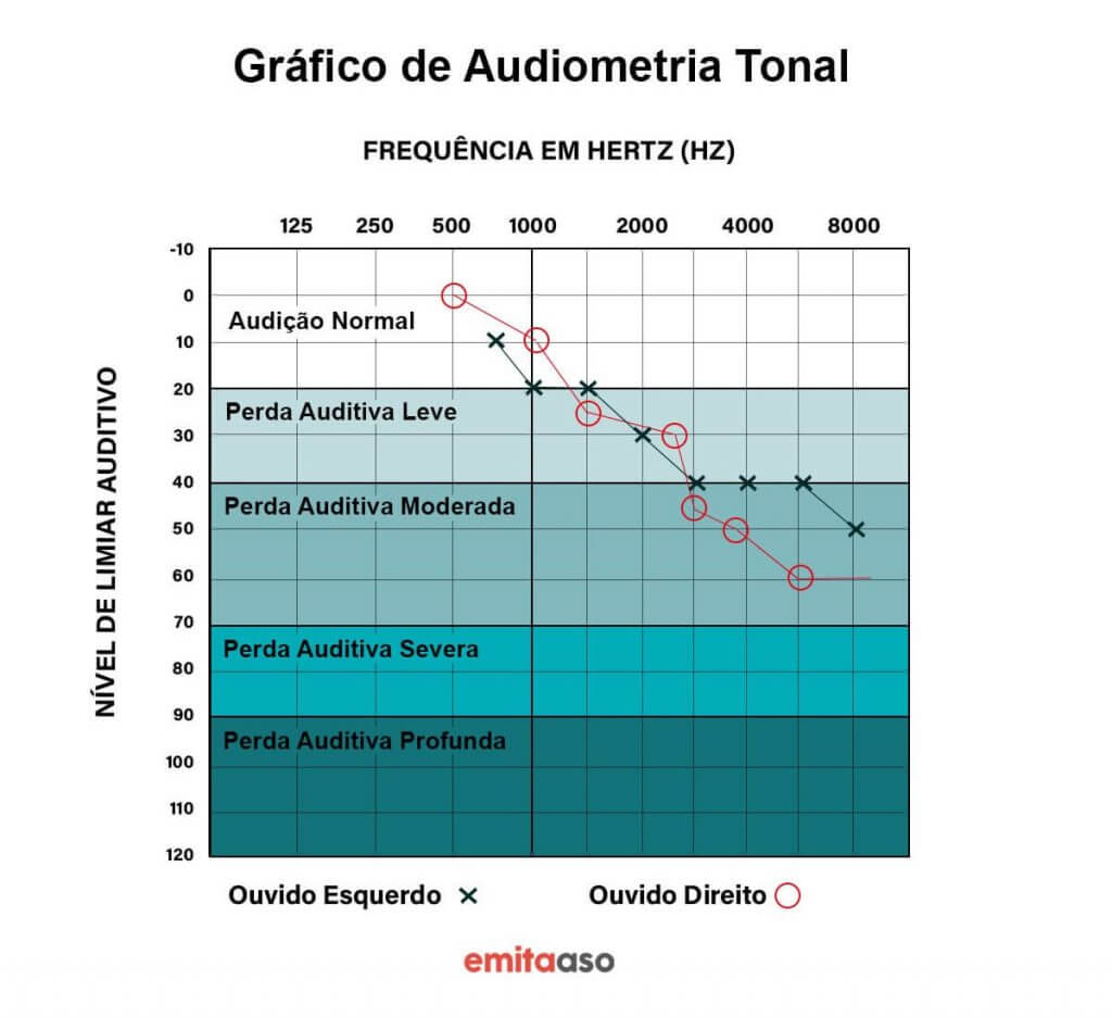 Gráfico de Audiometria Tonal